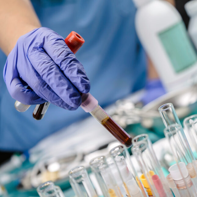 A hand in a glove takes a vial of blood sample out of a rack while holding two other vials — coverage from STAT